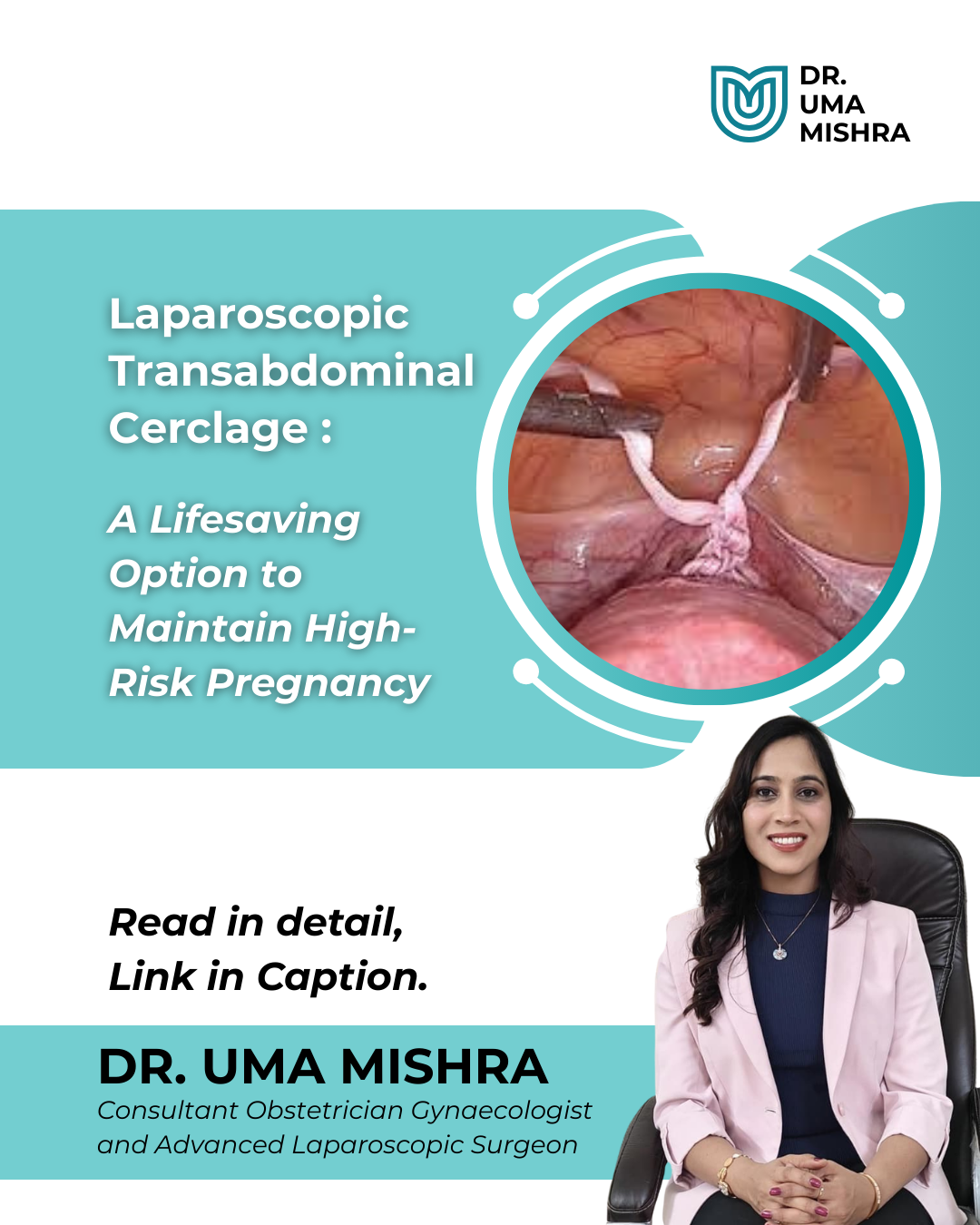 Laparoscopic Cerclage in Raipur