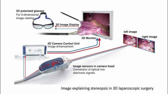 Laparoscopic gynecologist in Raipur