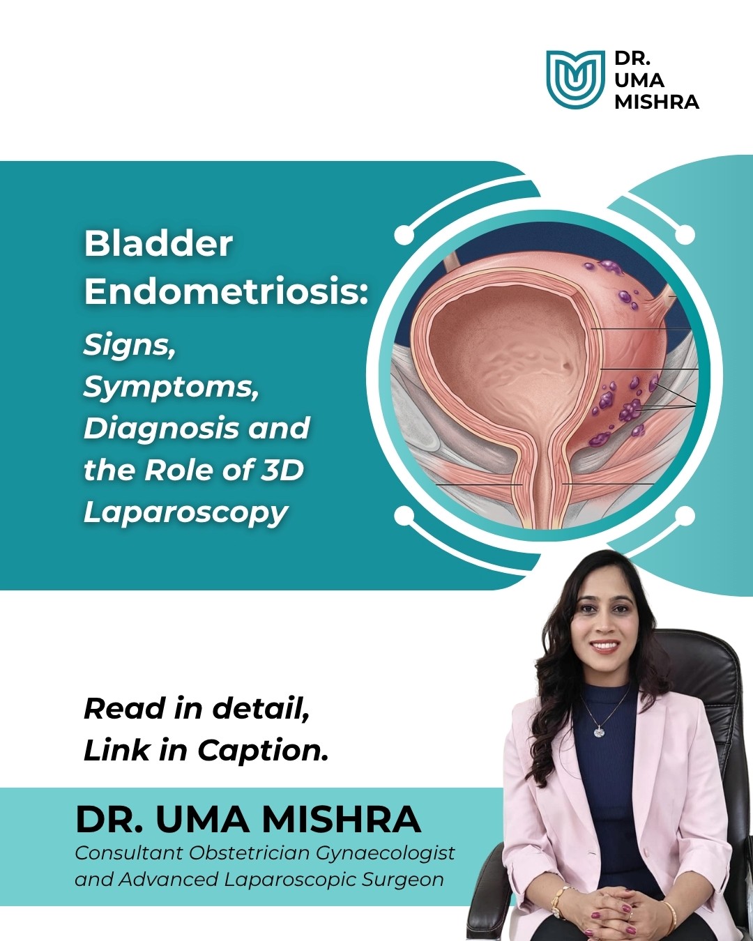 Bladder endometriosis treatment in Raipur with Dr Uma Mishra